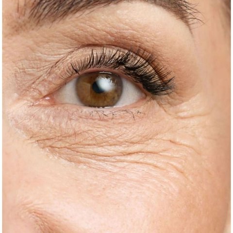 Rugas à volta dos olhos